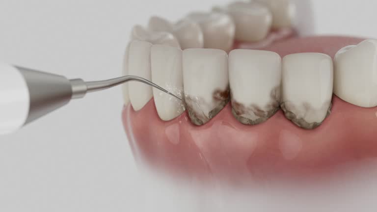 Reliable Dental contractor in Twin Lakes, WI by Smile Center Dentistry